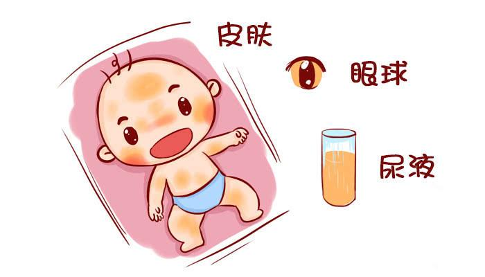 新生兒出生沒黃疸，大多是孕媽在孕期做了3件事