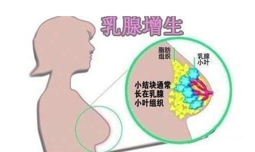 乳房出現(xiàn)“青筋”是什么原因呢？