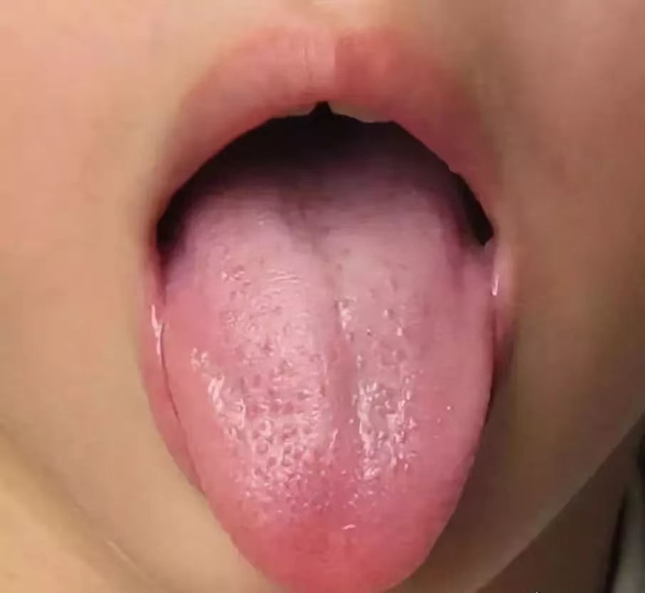 過度喂養(yǎng)危害大，寶寶發(fā)出的積食信號你能看懂多少？