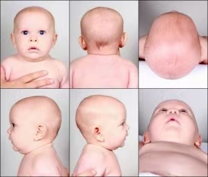 育兒小妙招|4個小妙招，幫寶寶睡出好頭型，趕緊收藏